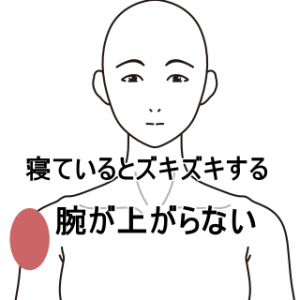 肩痛 五十肩 四十肩 の治療例 神奈川県厚木市の鍼灸 はりきゅう 専門 県央治療院 小田急線本厚木駅徒歩３分